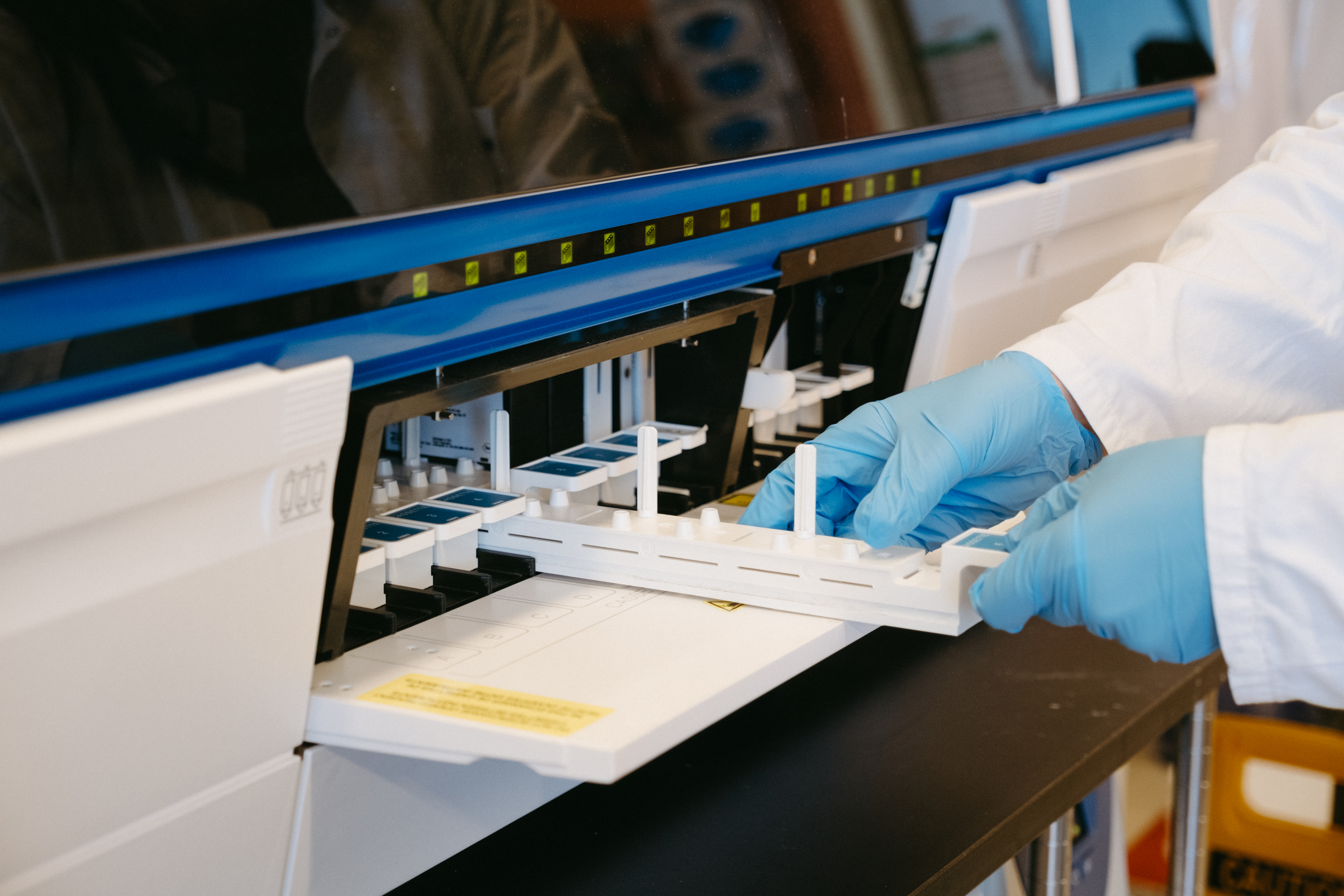 Fermentation & Downstream Development and Optimization